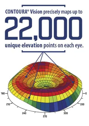 Contoura Vision