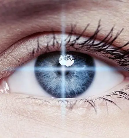 LASIK_REcovery