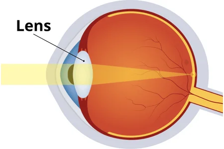 Lens_eye_anatomy