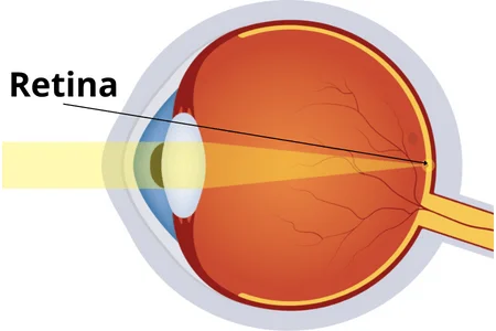 Retina