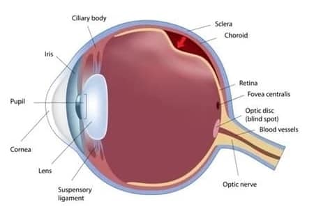 Retinal detachment