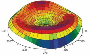 Contoura Vision: The Revolutionary Way to Correct Your Vision
