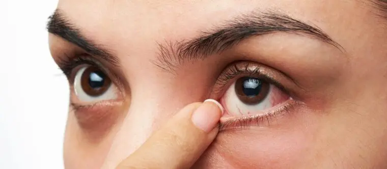 लेसिक की जटिलताएं और सुझाव – Complications And Tips Of LASIK In Hindi