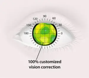 Is Contoura Surgery Effective?