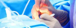 Limitations Of Eye Surgery