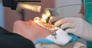 What Is The Lasik Procedure?