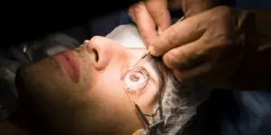 Is Eye LASIK Painful?