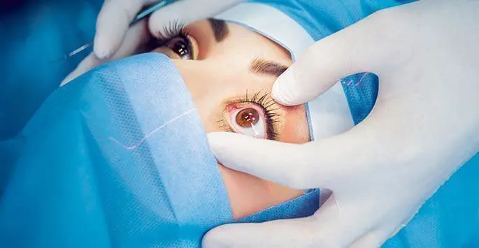 The Truth About Lasik Surgery: Everything You Need to Know