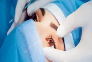 What Is Specs Removal Surgery?