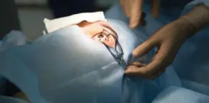 What Risks Involved In c-Lasik?