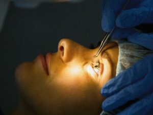 What Does Correct Refractive Surgery Mean?