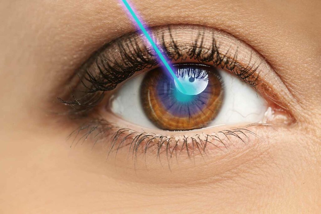 How Custom Lasik Can Help You See Perfectly