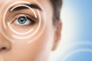 Lasik Surgery Meaning?