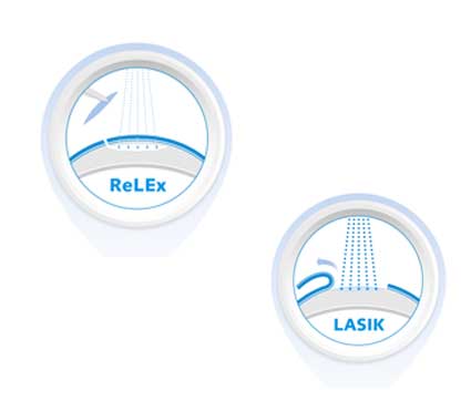 What Is ReLEx Eye Surgery? Things You Need To Know