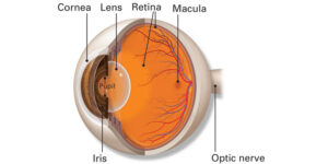 What Is Lasik?