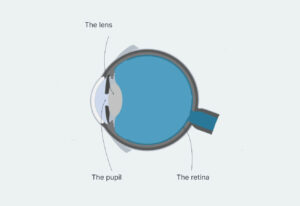What is Presbyopia?