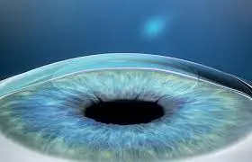 What Is The Procedure Of Visumax Lasik?