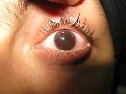 Are There Any Side Effects?