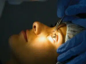 Complications You Might Experience After PRK Surgery