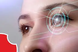 How To Choose ICL Surgery Doctor In Bengaluru?