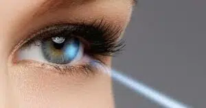 Is There Any Alternative To Lasik Eye Surgery?