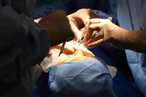 Blade Lasik: The Pros and Cons